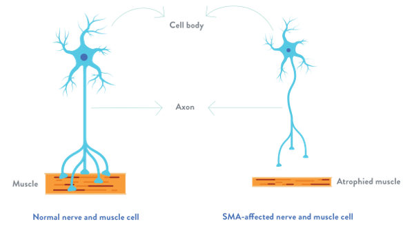 Brain Smn SMN1/2 – GC Genome